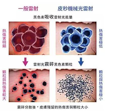 最新皮秒激光手艺，刷新与应用远景展望